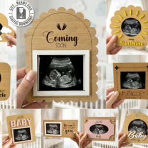 Marcos para Ecografía Baby Scan – Pack Vectorial Personalizable para Corte Láser
